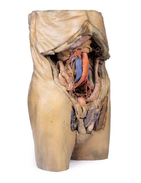 Dissezione dell'addome con ernie bilaterali - Erler Zimmer 3D anatomy Series MP1130