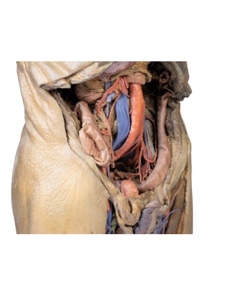 Disección del abdomen con hernias bilaterales - Erler Zimmer 3D anatomy Series MP1130