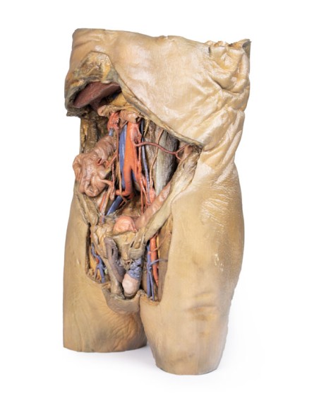 Disección del abdomen con hernias bilaterales - Erler Zimmer 3D anatomy Series MP1130