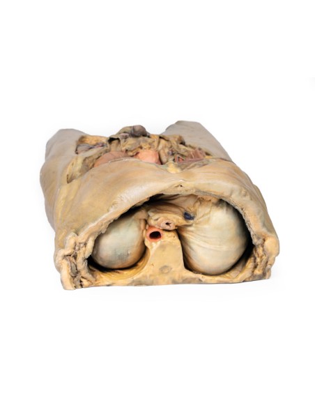 Dissezione dell'addome con ernie bilaterali - Erler Zimmer 3D anatomy Series MP1130