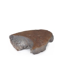 Disección del hilio del pulmón derecho - Erler Zimmer 3D... 2