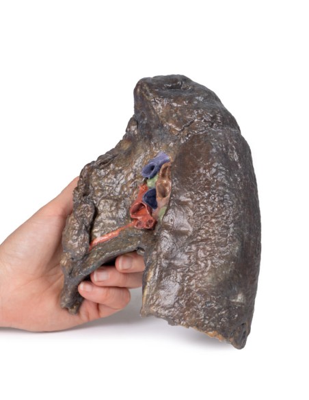 Dissection of the hilum of the right lung - Erler Zimmer 3D anatomy Series MP1127