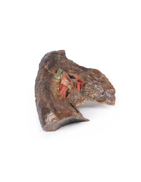 Ilo del polmone sinistro - Erler Zimmer 3D anatomy Series MP1124