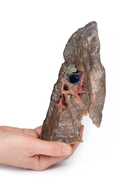 Ilo der linken Lunge - Erler Zimmer 3D-Anatomie Serie MP1124