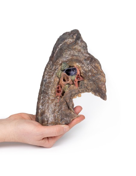 Ilo of the left lung - Erler Zimmer 3D anatomy Series MP1124