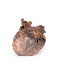 Dissection du coeur humain - Erler Zimmer 3D anatomy... 2