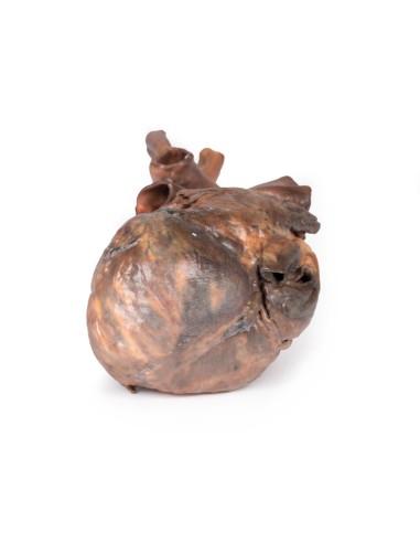 Dissezione del cuore umano - Erler Zimmer 3D...