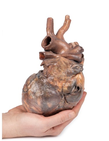 Disección de corazón humano - Erler Zimmer 3D...