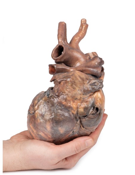 Dissection of the human heart - Erler Zimmer 3D anatomy Series MP1123
