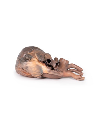 Dissection of the human heart - Erler Zimmer 3D...