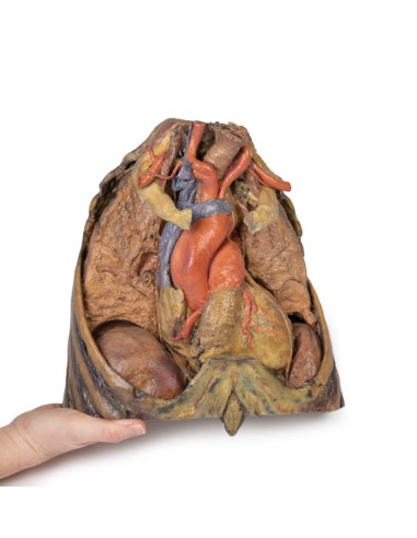 Disección de tórax con corazón y vasos - Erler...