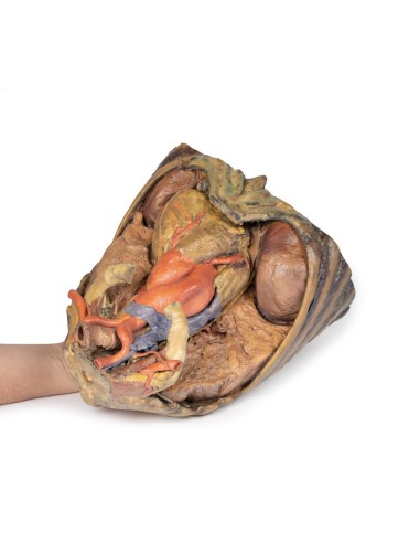 Dissection thoracique avec cœur et vaisseaux -...