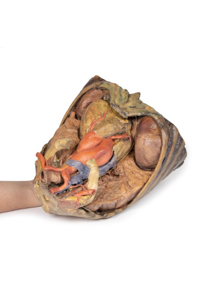 Brustkorbpräparation mit Herz und Gefäßen - Erler Zimmer 3D-Anatomie Serie MP1122