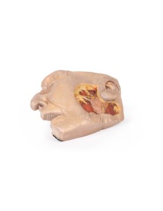 Dissection de la glande parotide et du nerf facial -...