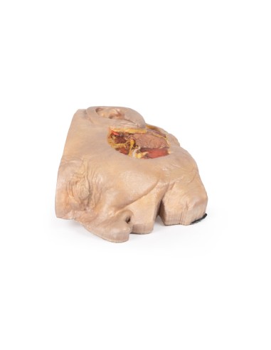 Präparation der Ohrspeicheldrüse und des...