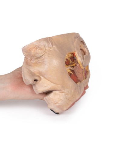 Präparation der Ohrspeicheldrüse und des...