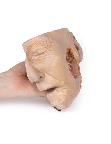 Präparation der Ohrspeicheldrüse und des...