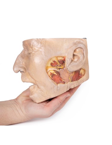 Präparation der Ohrspeicheldrüse und des...