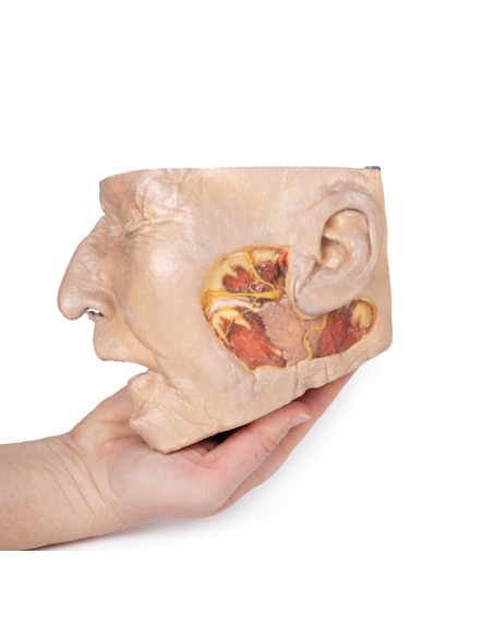 Dissection of the parotid gland and facial nerve - Erler Zimmer 3D anatomy Series MP1112