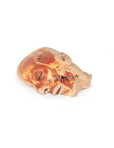 Surface dissection of the face - Erler Zimmer 3D anatomy... 2