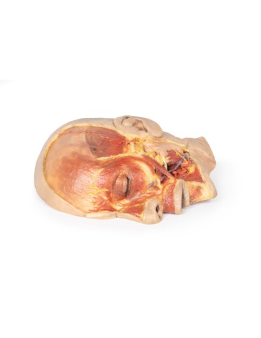 Surface dissection of the face - Erler Zimmer...