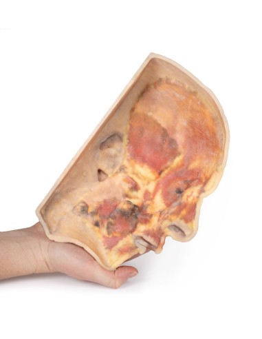 Surface dissection of the face - Erler Zimmer...