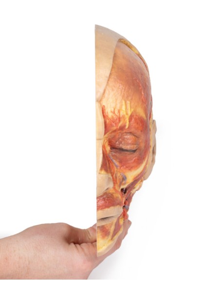 Oberflächenpräparation des Gesichts - Erler Zimmer 3D-Anatomie Serie MP1108