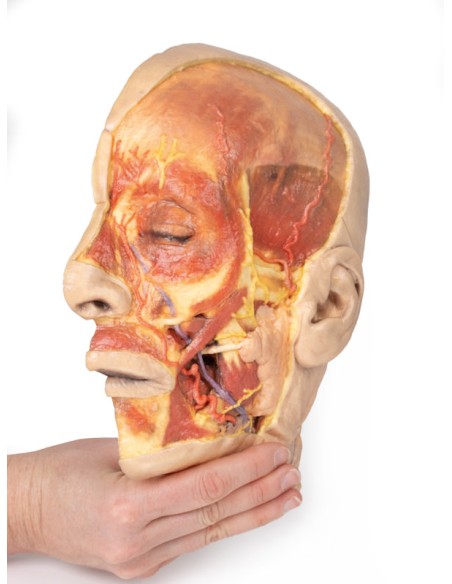 Surface dissection of the face - Erler Zimmer 3D anatomy Series MP1108