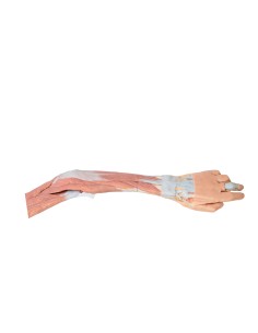 Dissection of the upper limb, elbow, forearm and hand -... 2