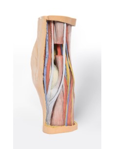 Disección profunda del hueco poplíteo - Erler Zimmer 3D... 2