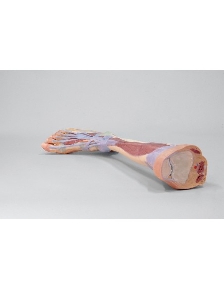 Tiefe Dissektion der unteren Extremität - Erler Zimmer 3D-Anatomie Serie MP1809