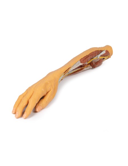 Oberflächliche und tiefe Präparation von Unterarm und Hand - Erler Zimmer 3D Anatomie Serie MP1512