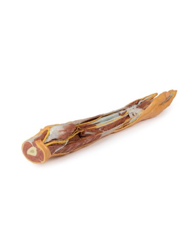 Dissection superficielle et profonde de...