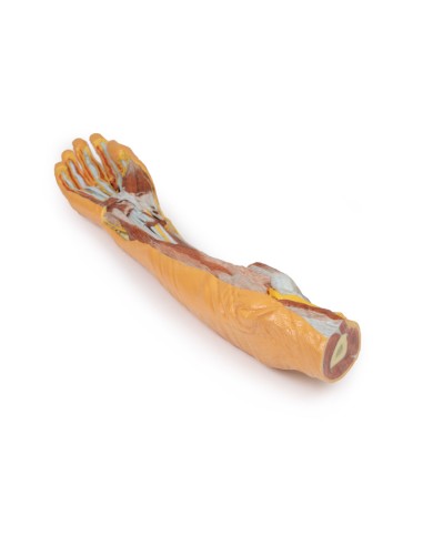 Dissection superficielle et profonde de...