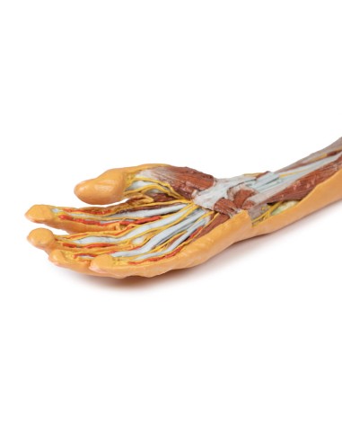 Dissection superficielle et profonde de...