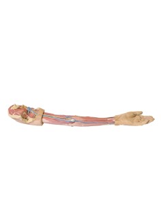 Dissection of the upper limb - Erler Zimmer 3D anatomy...