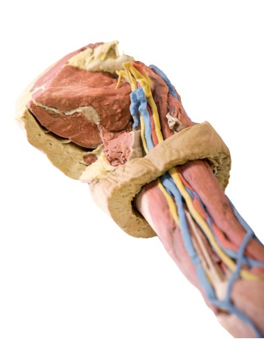 Dissection of the upper limb - Erler Zimmer 3D...