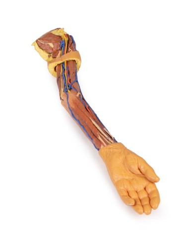 Dissection of the upper limb - Erler Zimmer 3D...