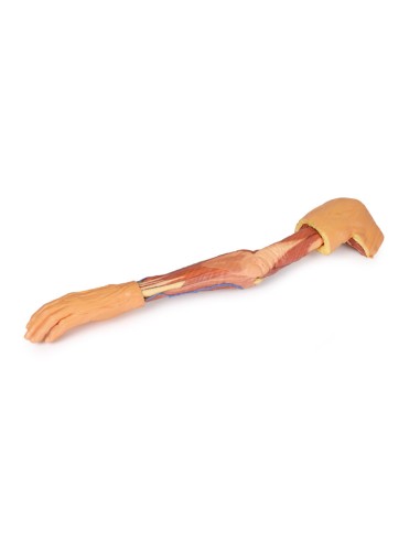 Dissection of the upper limb - Erler Zimmer 3D...