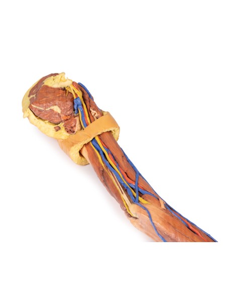 Dissezione dell'arto superiore - Erler Zimmer 3D anatomy Series MP1500