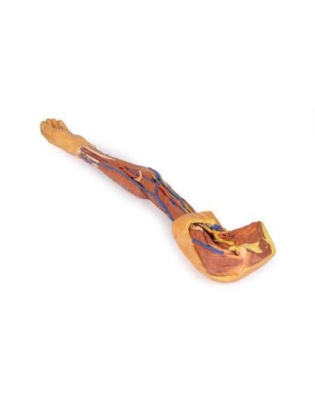 Dissection du membre supérieur - Erler Zimmer 3D anatomy Series MP1500
