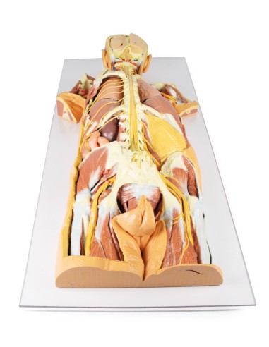 Dissection du système nerveux (vue arrière) -...