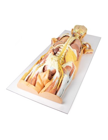 Dissection of the nervous system (Rear view) -...