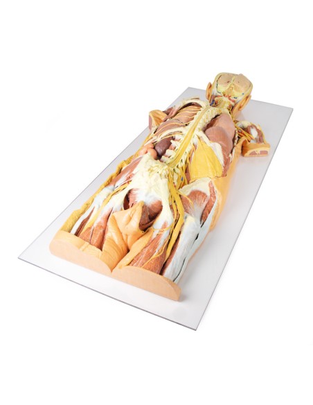 Präparation des Nervensystems (Rückansicht) - Erler Zimmer 3D Anatomie Serie MP1400