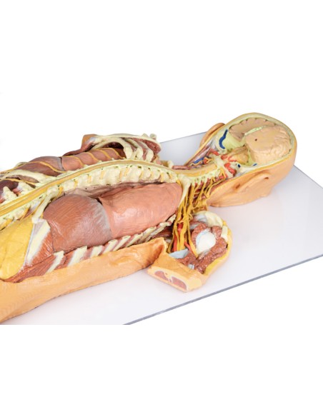 Dissection of the nervous system (Rear view) - Erler Zimmer 3D anatomy Series MP1400