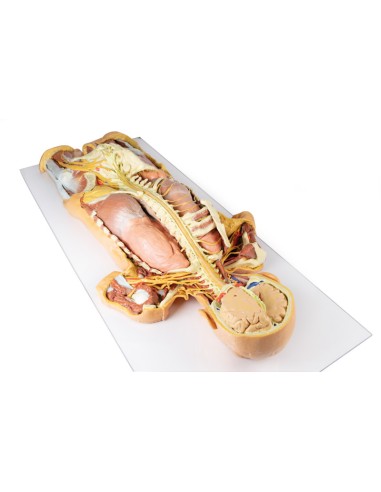 Dissection du système nerveux (vue arrière) -...