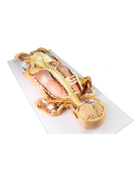 Disección del sistema nervioso (Vista posterior) - Erler Zimmer 3D anatomy Series MP1400