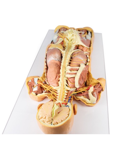 Präparation des Nervensystems (Rückansicht) - Erler Zimmer 3D Anatomie Serie MP1400