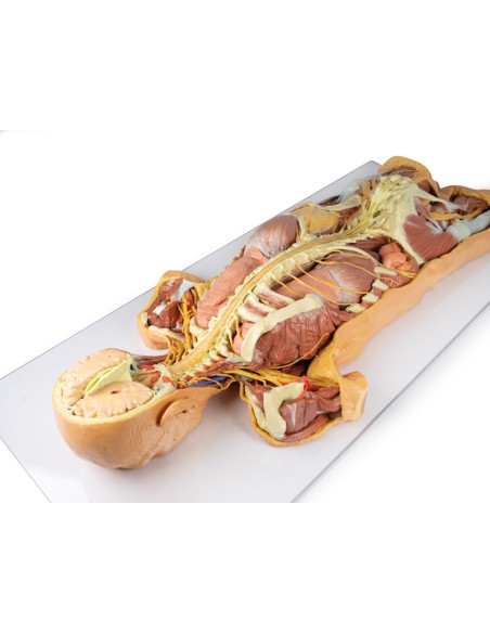 Dissezione del sistema nervoso (Vista posteriore) - Erler Zimmer 3D anatomy Series MP1400