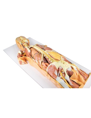 Dissection of the nervous system (Rear view) -...